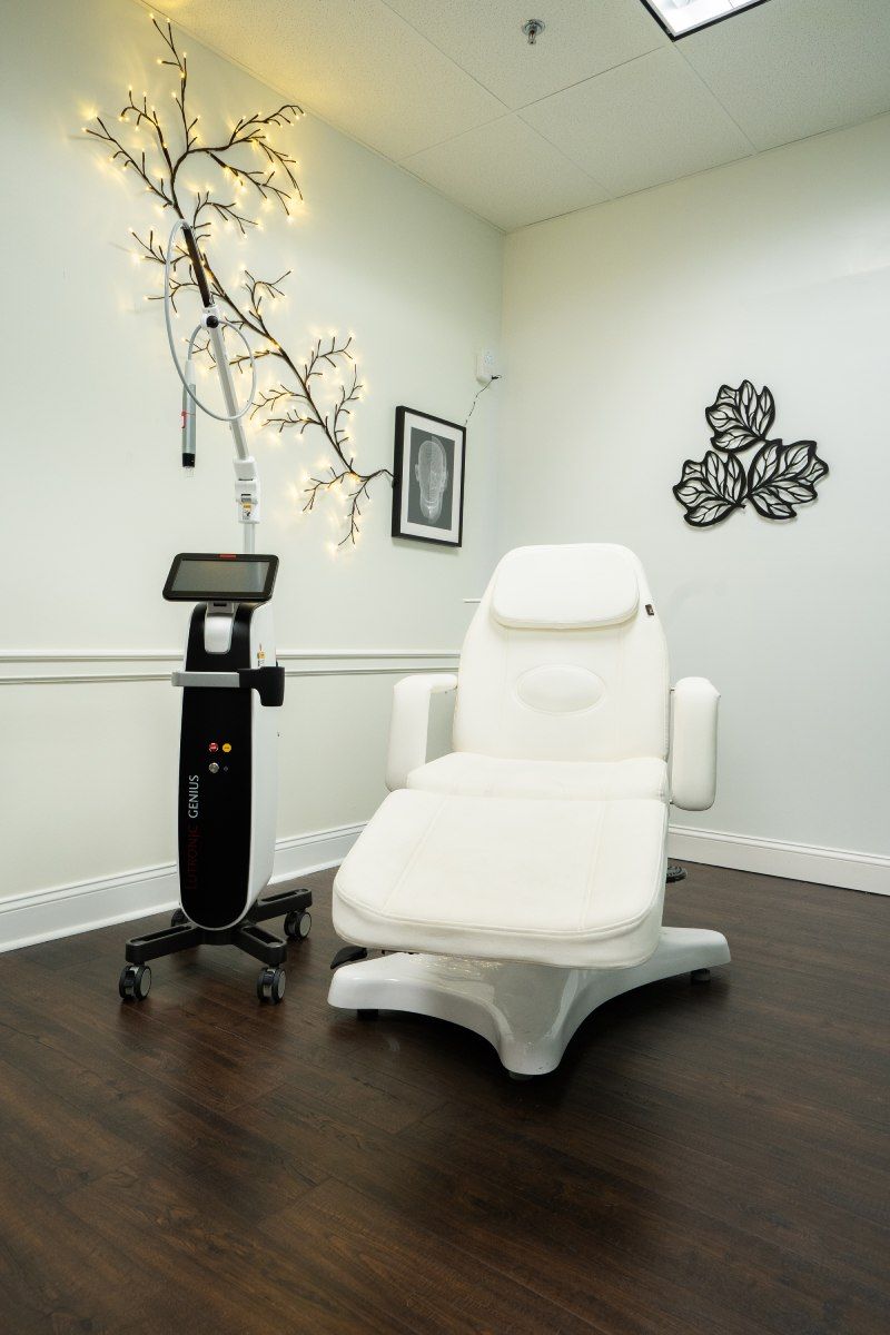 rf microneedling ardmore feature - woman with blonde wavy hair