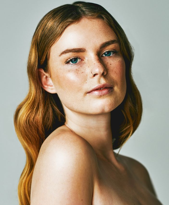 skin resurfacing ardmore feature - woman with wavy brunette hair 